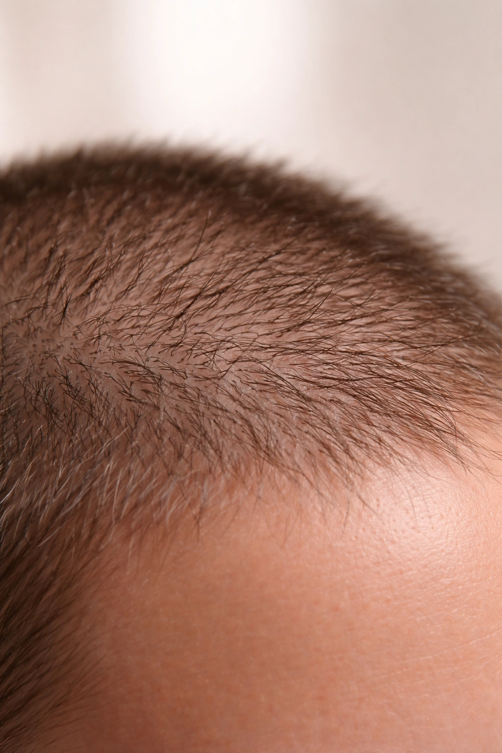 Close-up of very short hair showing breakage on the scalp