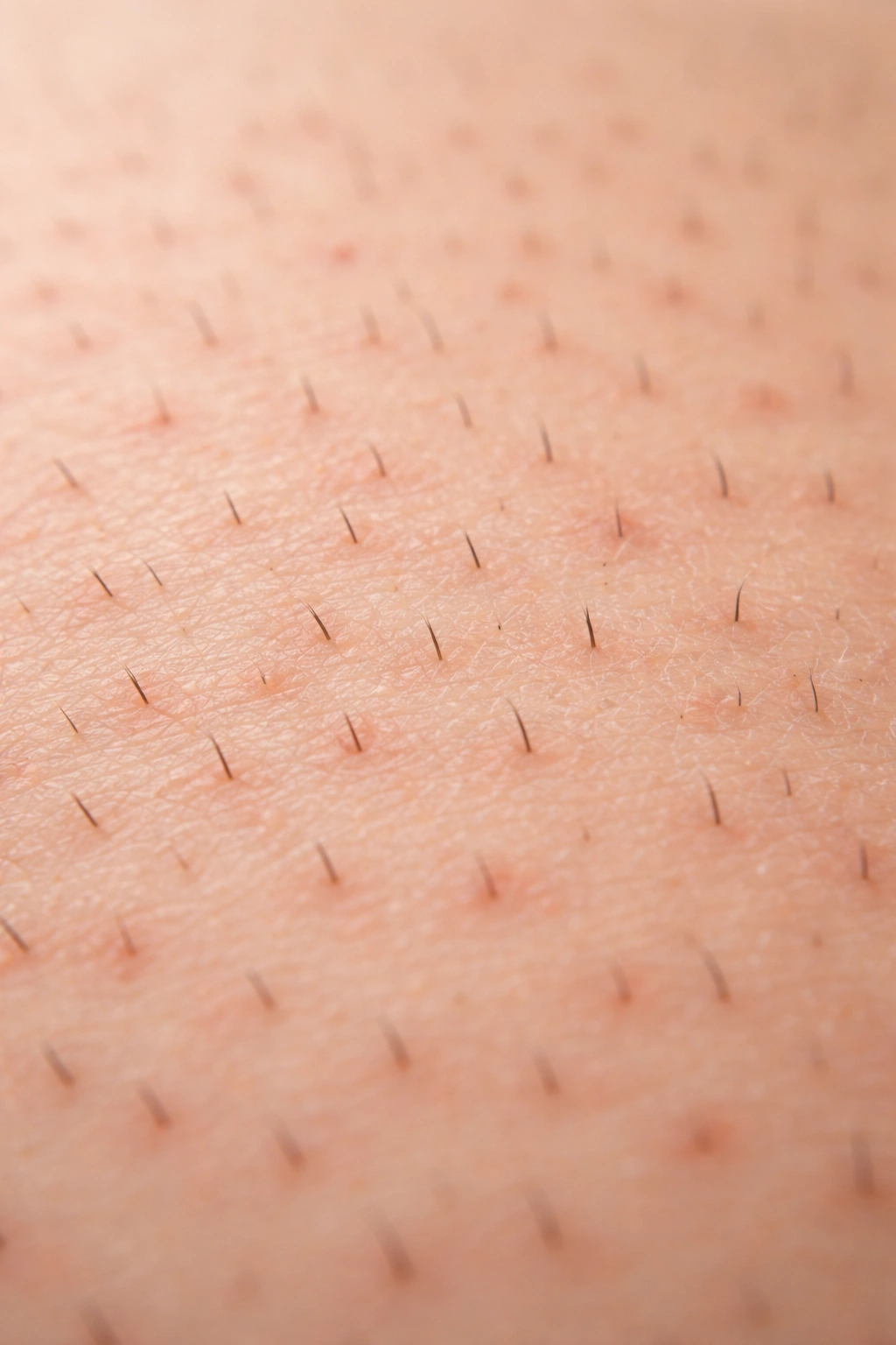 Macro image of very short hairs on skin with mild redness around follicles